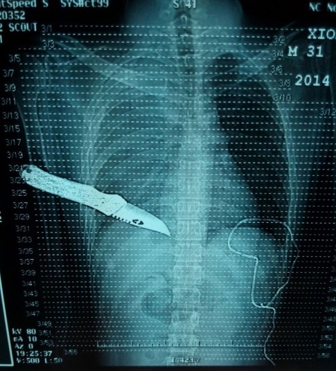 عجیب وغریب‌ترین عکس‌های اشعه ایکس در جهان